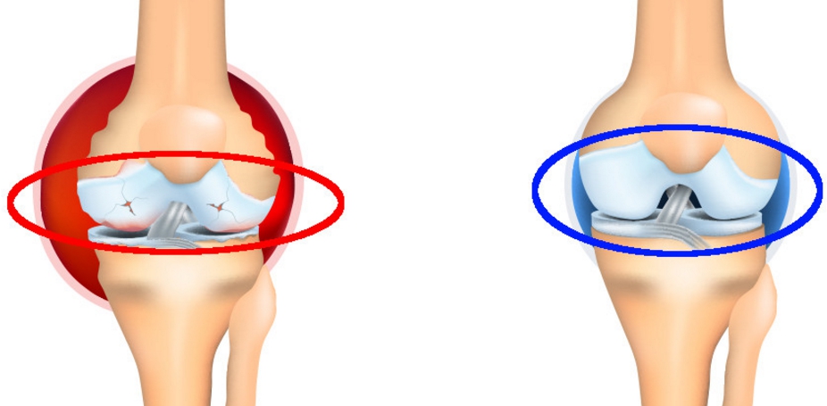 ネルソンズドッグフード
